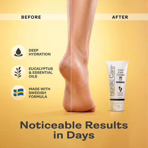 10% Urea Foot Cream
